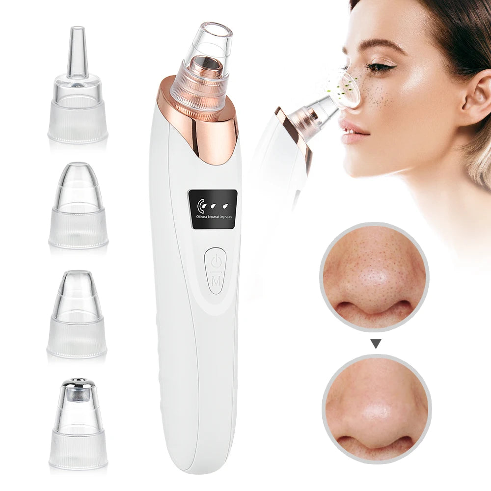 Professional Blackhead Remover Vacuum – Deep Cleansing Pore Cleaner | 5 Heads Acne Suction Device for Face Care